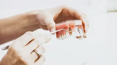 Nowoczesne technologie w implantologii: Jak zmieniają świat stomatologii?
